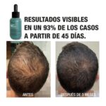 TAHE PEPTIDE T98 ANTI-HAIRLOSS TREATMENT 50ML - Image 6